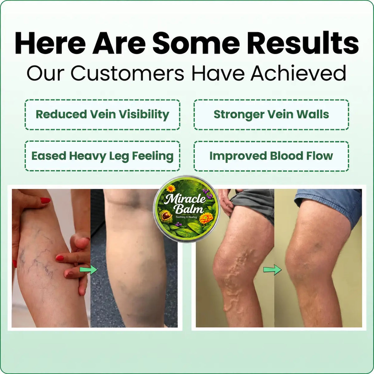 Herbal Miracle Balm for Varicose Veins Relief